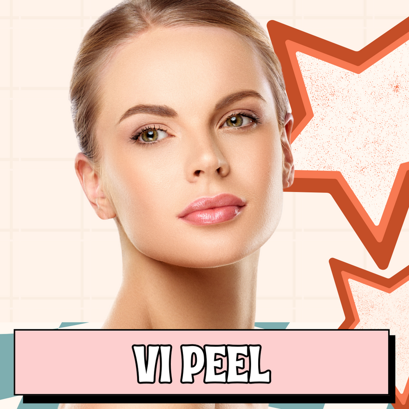 Vi Peel - Chemical Peel BABE Sale
