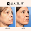 HA Fillers BABE Sale