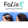 FoLix Laser Hair Regeneration