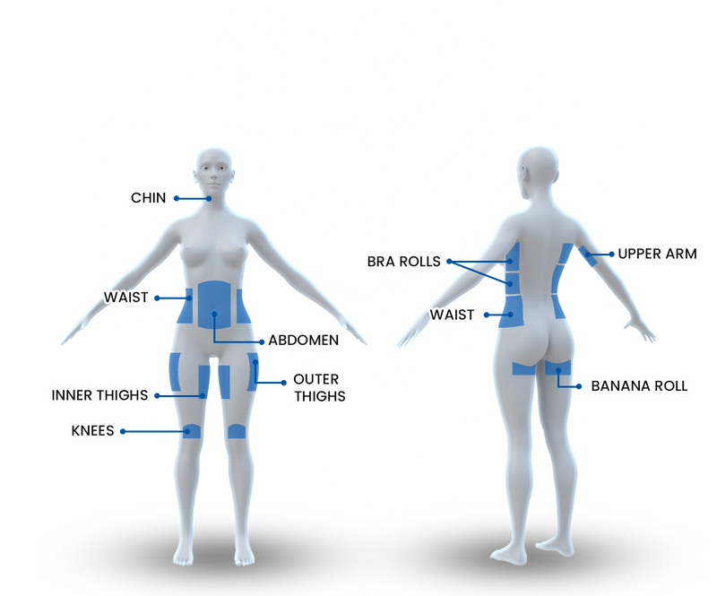 CoolSculpting Élite