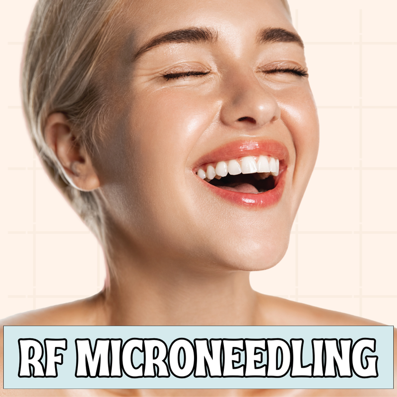 RF Microneedling