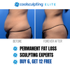 CoolSculpting Elite Black Friday Sale