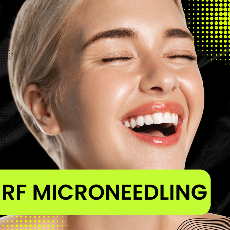 RF Microneedling