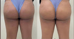 Body Injectables
