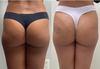 Body Injectables